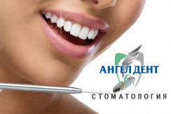Профессиональная чистка зубов и скайсы со скидкой до 70% в стоматологии «Ангел Дент»